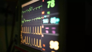 Hypoxic cardiac arrest: symptoms, prevention, and why it matters (more than ever) now