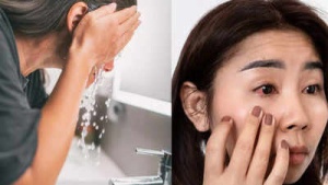 Tap Water Alert: Hidden Eye Infection Risk for Contact Lens Wearers - Know the Symptoms of Acanthamoeba Keratitis